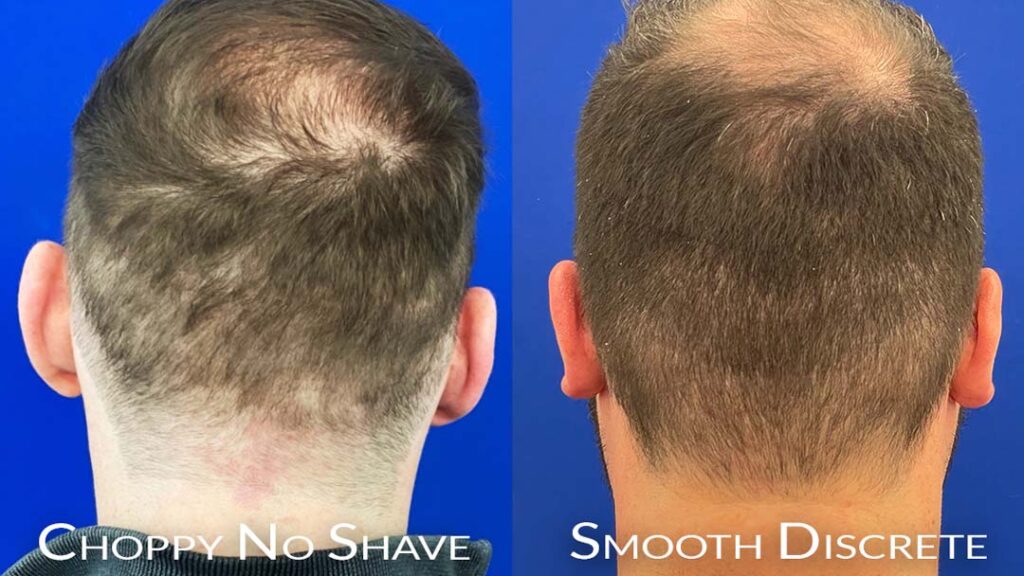 B&F no shave fue chicago