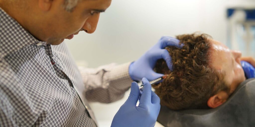 top hair replacement