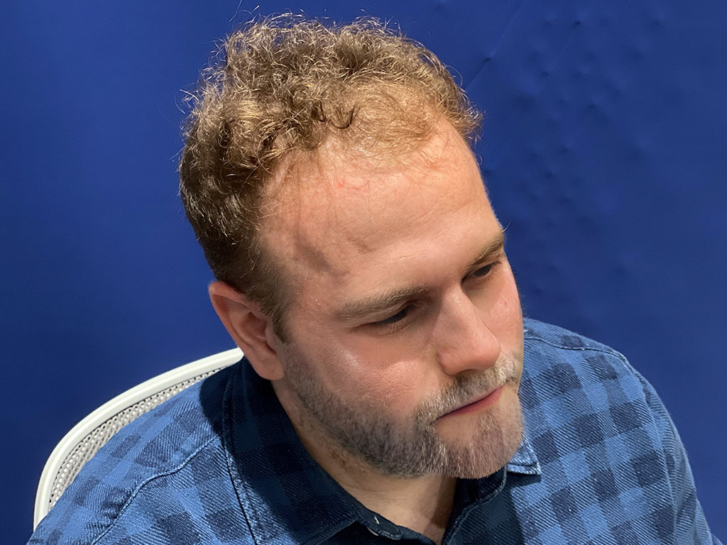 elias 01